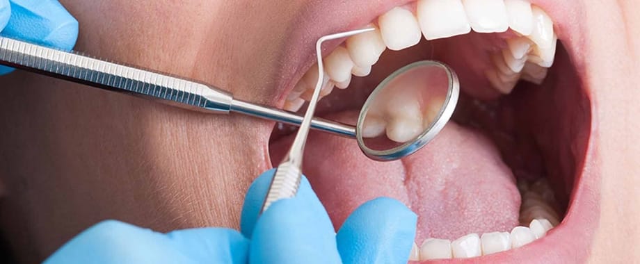 dentaltamayo-tratamiento-blanqueamiento-dental