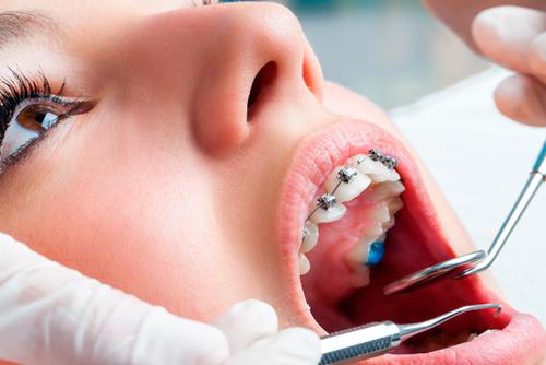 Tratamiento ortodoncia